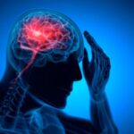 Brain Injury