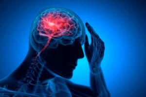 Brain Injury